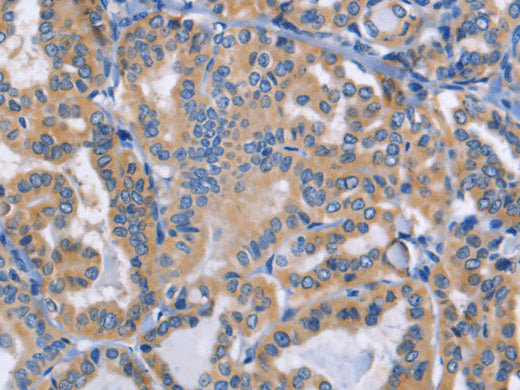 DOK4 Polyclonal Antibody Store at -20°C - MSE Supplies LLC
