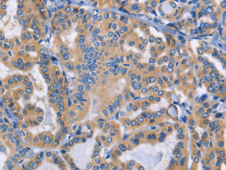 DOK4 Polyclonal Antibody Store at -20°C - MSE Supplies LLC