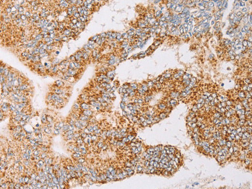 YARS2 Polyclonal Antibody Store at -20°C - MSE Supplies LLC