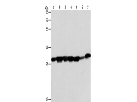 AK2 Polyclonal Antibody Store at -20°C
