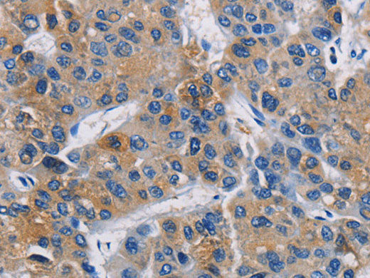 GPM6A Polyclonal Antibody Store at -20°C
