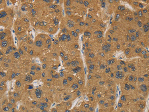 CYP17A1 Polyclonal Antibody Store at -20°C