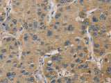 TBXAS1 Polyclonal Antibody Store at -20°C
