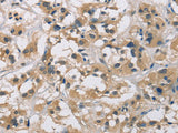 CYR61 Polyclonal Antibody Store at -20°C