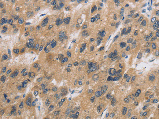 CST6 Polyclonal Antibody Store at -20°C