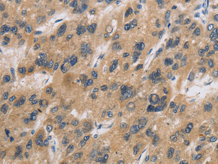 CST6 Polyclonal Antibody Store at -20°C