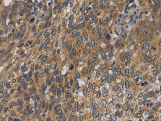 Cytochrome b5 Polyclonal Antibody Store at -20°C