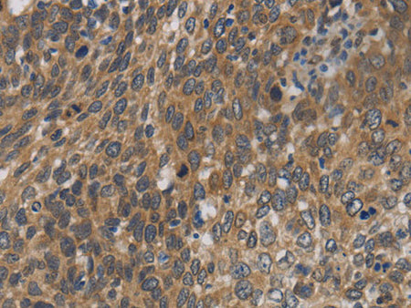 Cytochrome b5 Polyclonal Antibody Store at -20°C