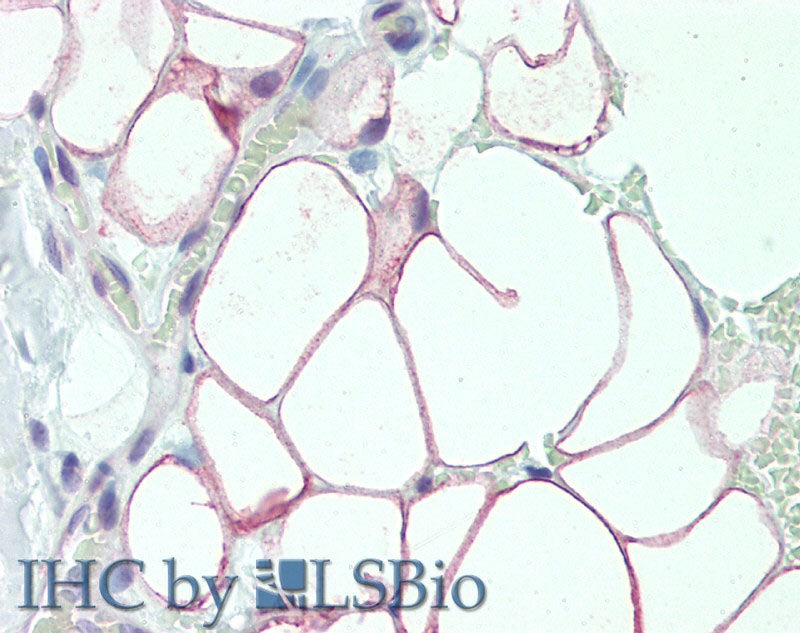 DCBLD2 Polyclonal Antibody Store at -20°C