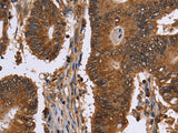 FANCF Polyclonal Antibody Host Rabbit