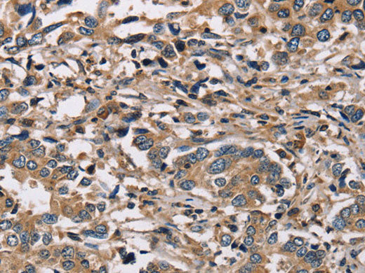 HSD17B12 Polyclonal Antibody Store at -20°C