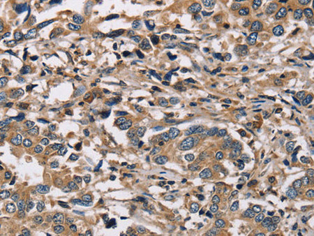 HSD17B12 Polyclonal Antibody Store at -20°C
