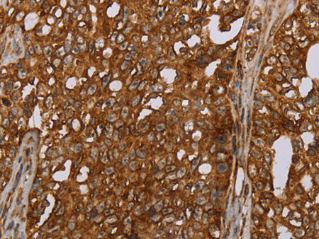 ERRFI1 Polyclonal Antibody Store at -20°C
