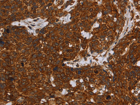 ERRFI1 Polyclonal Antibody Store at -20°C