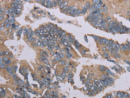 MMP20 Polyclonal Antibody Store at -20°C