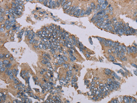 MMP20 Polyclonal Antibody Store at -20°C