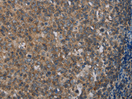 MMP20 Polyclonal Antibody Store at -20°C