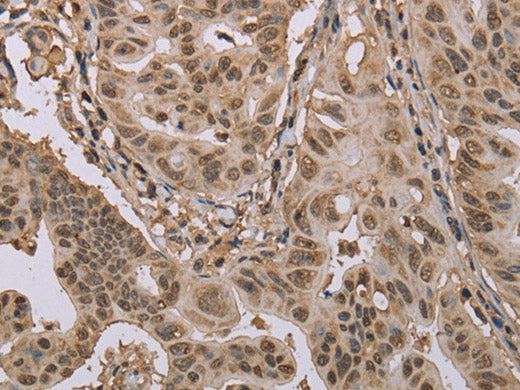 CAB39 Polyclonal Antibody Store at -20°C