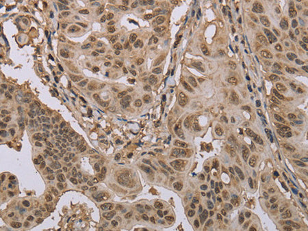 CAB39 Polyclonal Antibody Store at -20°C