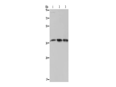CAB39 Polyclonal Antibody Store at -20°C