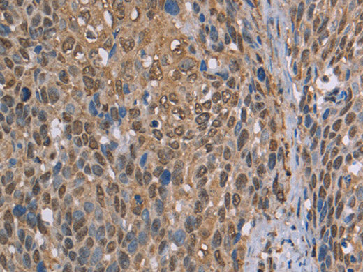 CAB39 Polyclonal Antibody Store at -20°C