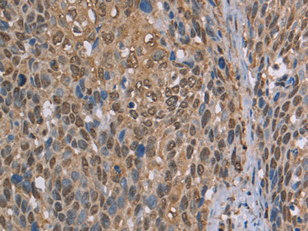 CAB39 Polyclonal Antibody Store at -20°C