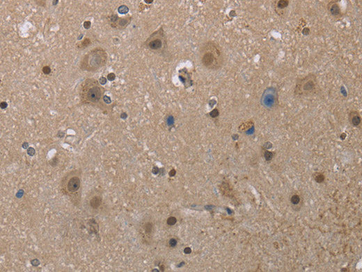 MGLL Polyclonal Antibody Store at -20°C