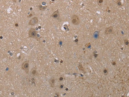 MGLL Polyclonal Antibody Store at -20°C