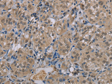 MGLL Polyclonal Antibody Store at -20°C