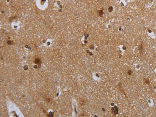 MTBP Polyclonal Antibody Store at -20°C