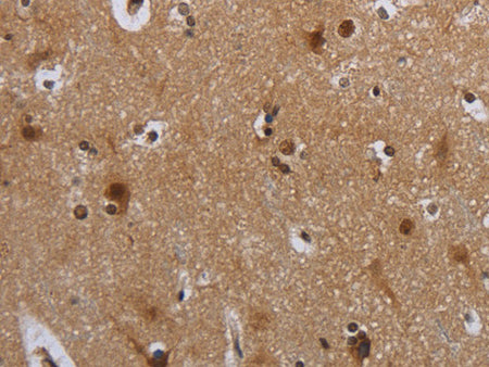 MTBP Polyclonal Antibody Store at -20°C