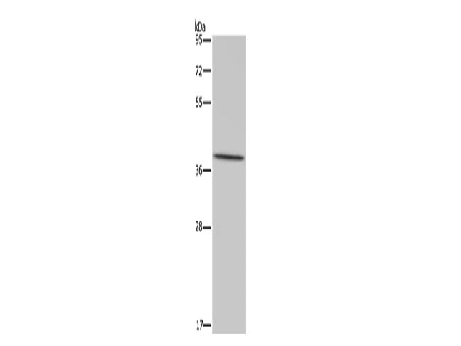MT-ND1 Polyclonal Antibody Store at -20°C
