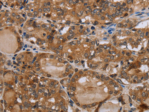 MT-ND1 Polyclonal Antibody Store at -20°C