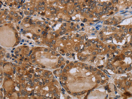 MT-ND1 Polyclonal Antibody Store at -20°C