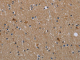 MYO7A Polyclonal Antibody Store at -20°C