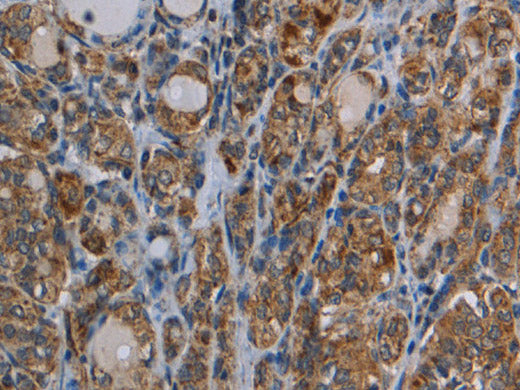 MYO7A Polyclonal Antibody Store at -20°C