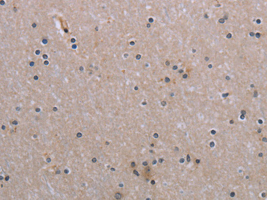 NAIP Polyclonal Antibody Store at -20°C