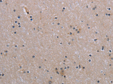 NAIP Polyclonal Antibody Store at -20°C
