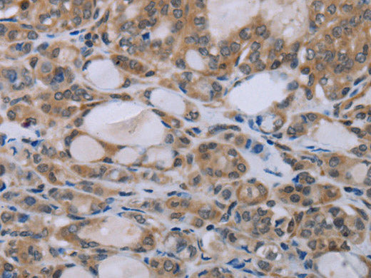 NAIP Polyclonal Antibody Store at -20°C