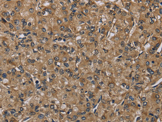 NLRP4 Polyclonal Antibody Store at -20°C