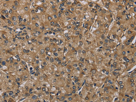 NLRP4 Polyclonal Antibody Store at -20°C