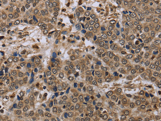 NLRP4 Polyclonal Antibody Store at -20°C