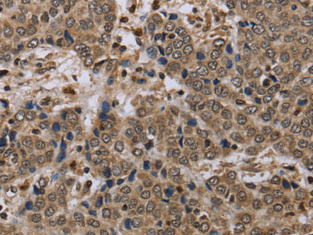 NLRP4 Polyclonal Antibody Store at -20°C