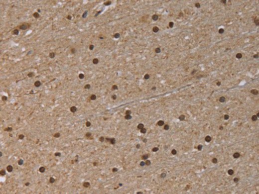 NLRP6 Polyclonal Antibody Store at -20°C