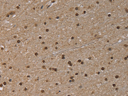 NLRP6 Polyclonal Antibody Store at -20°C