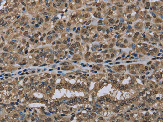 NLRP6 Polyclonal Antibody Store at -20°C