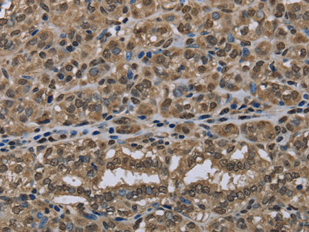 NLRP6 Polyclonal Antibody Store at -20°C