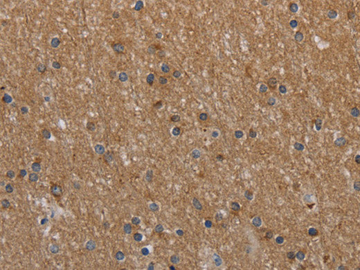 NAA25 Polyclonal Antibody Store at -20°C
