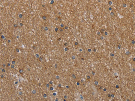 NAA25 Polyclonal Antibody Store at -20°C