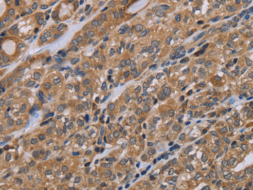 NAA25 Polyclonal Antibody Store at -20°C